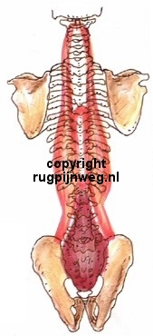 spiercorset ruggegraat