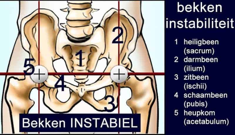 Bekkeninstabiliteit